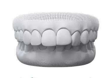 overbite