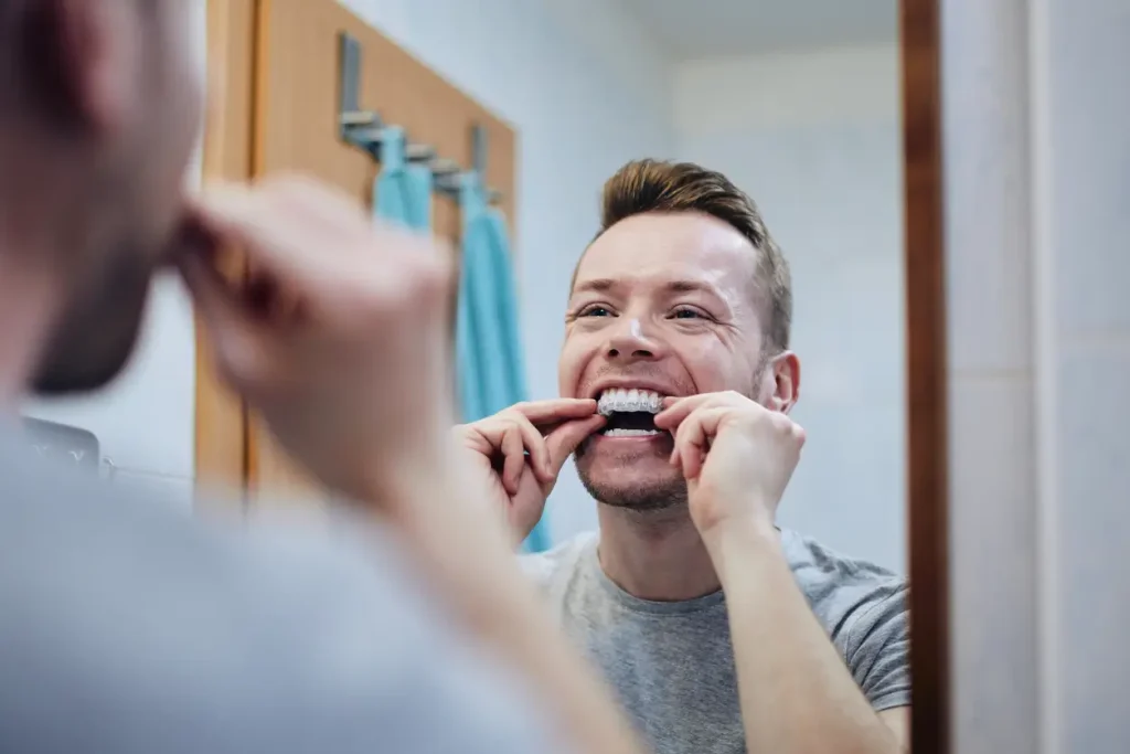 invisalign